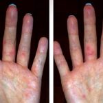 Koksaki virüsü nedeniyle bazı Rus turistler Antalya’dan erken ayrıldı