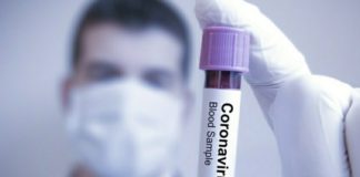 Ankara covid test merkezleri