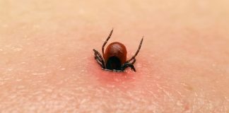 Kene ile Bulaşan 10 Hastalık ve Korunmak İçin 10 Önlem Kene